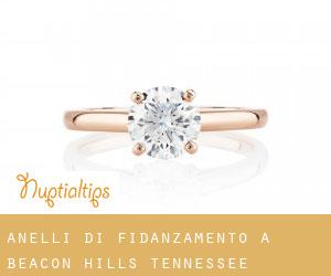 Anelli di fidanzamento a Beacon Hills (Tennessee)