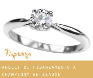 Anelli di fidanzamento a Champigny-en-Beauce