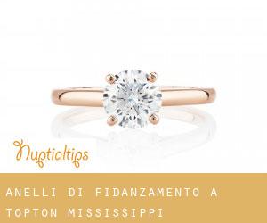 Anelli di fidanzamento a Topton (Mississippi)