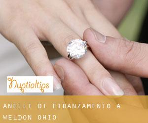 Anelli di fidanzamento a Weldon (Ohio)
