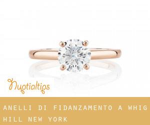 Anelli di fidanzamento a Whig Hill (New York)