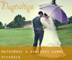 matrimoni a Agnières (Somme, Picardia)